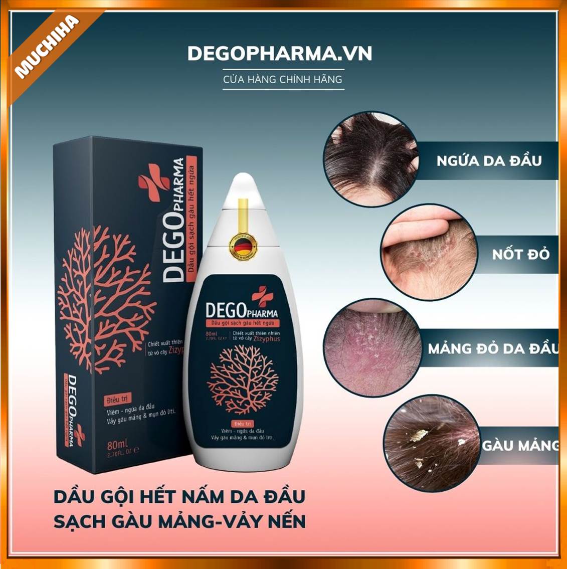 Dầu Gội Dego Pharma Chính Hãng, Dầu Gội Dego Trị Nấm Gàu, Trị Ngứa Da Đầu Chai 80ml 11 Dầu Gội Dego Pharma Có Công Dụng Gì?