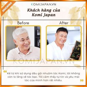 Dau goi phu bac Komi chinh hang mua o dau phan hoi khac hang Dau goi Komi co tot khong Muchiha review 13